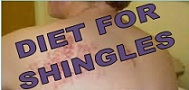 shingles diet 1